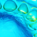 Additional Silicone Putty